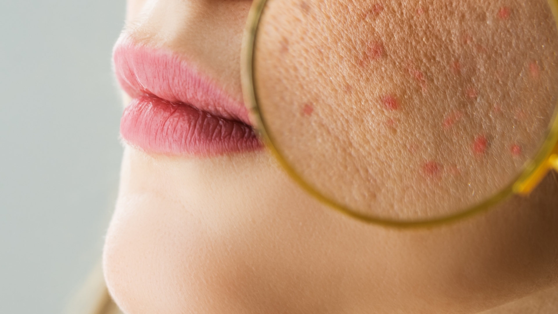 Looking at skin Dermatologist Looking at skin Dermatologist